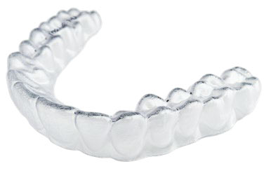 Abb. 5: Beispiel für einen ClearCorrect- Aligner Foto: Straumann Group