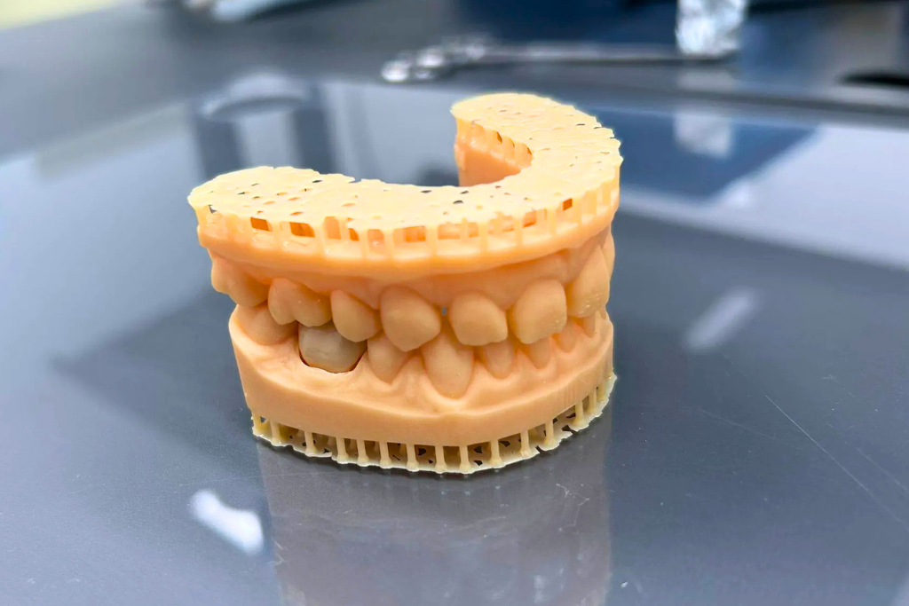 3D-gedrucktes Modell eines Ober- und Unterkiefers mit detaillierter Darstellung der Zahnreihen.